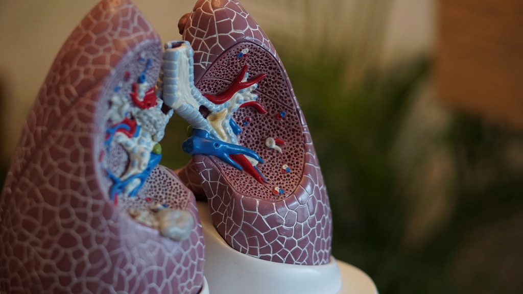 There's a Connection to ULEZ and the Growth of Lung Cancer